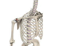 Acromioclavicular (AC) Joint Osteoarthritis