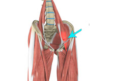 Hip Flexor Strain