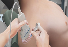 Ultrasound-Guided Shoulder Injections